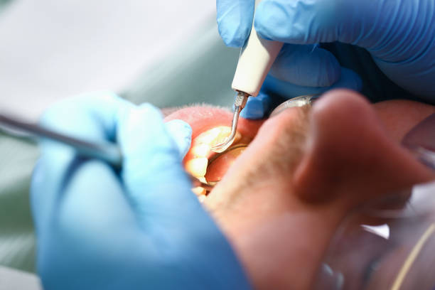 Best Emergency Gum Pain Relief  in Springhill, LA